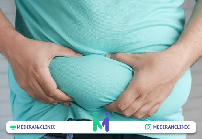 ابدومینوپلاستی جراحی