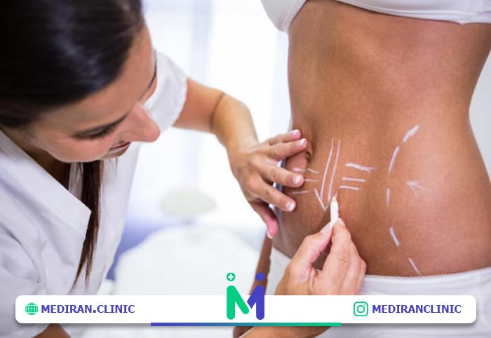 نکات مثبت تامی تاک