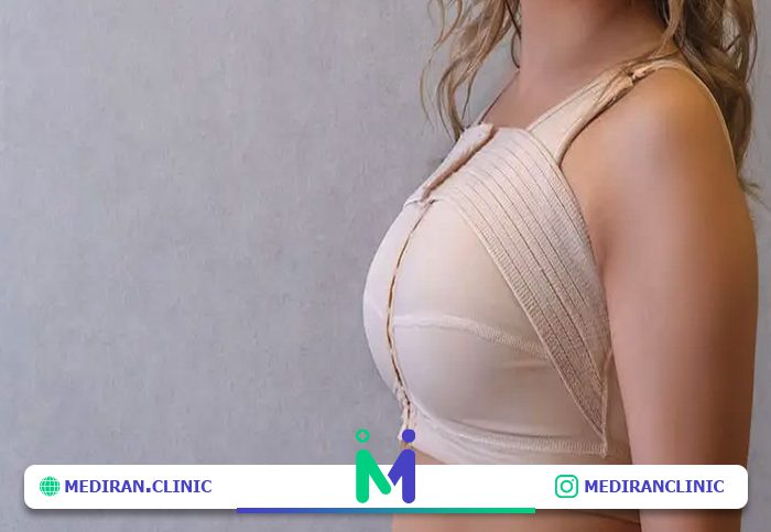 بستن سوتین طبی؛ از مهمترین مراقبت های بعد از عمل ماموپلاستی
