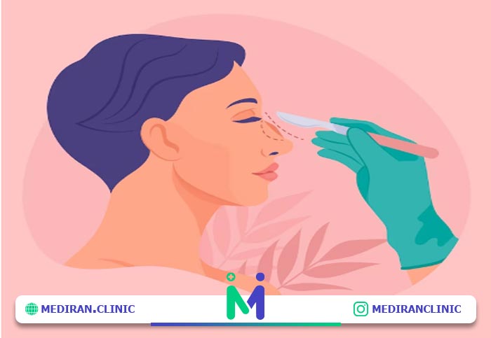 پیش از جراحی بینی چه کنیم